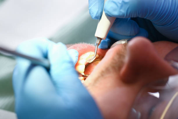 Best Emergency Tooth Extraction in Steele Creek, AK