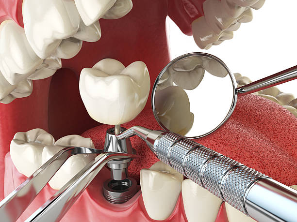 Reliable AK Emergency Dentist Solutions