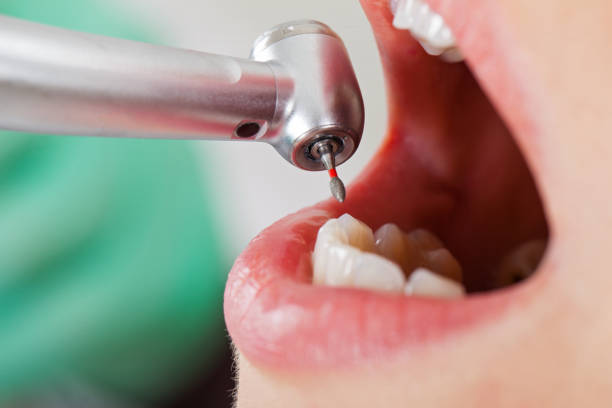 Best Emergency Dental Care for Trauma or Injury in Steele Creek, AK